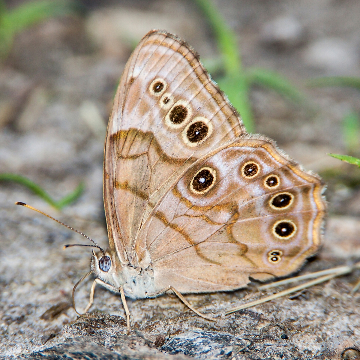 Pearly eye